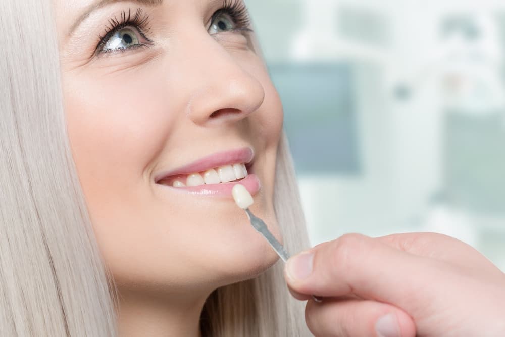 The Advantages of Dental Polishing Treatment